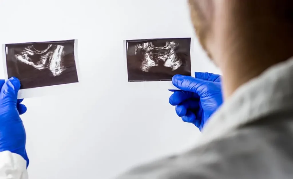 Lebenserwartung bei Prostatakrebs