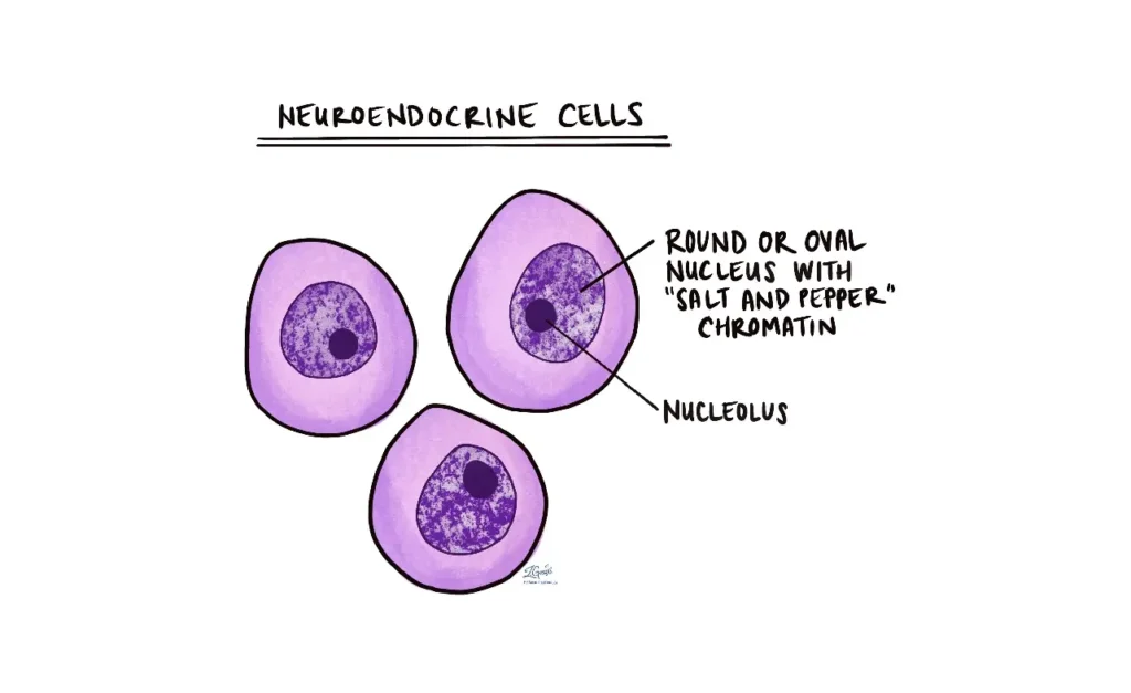 Neuroendokrine Zellen