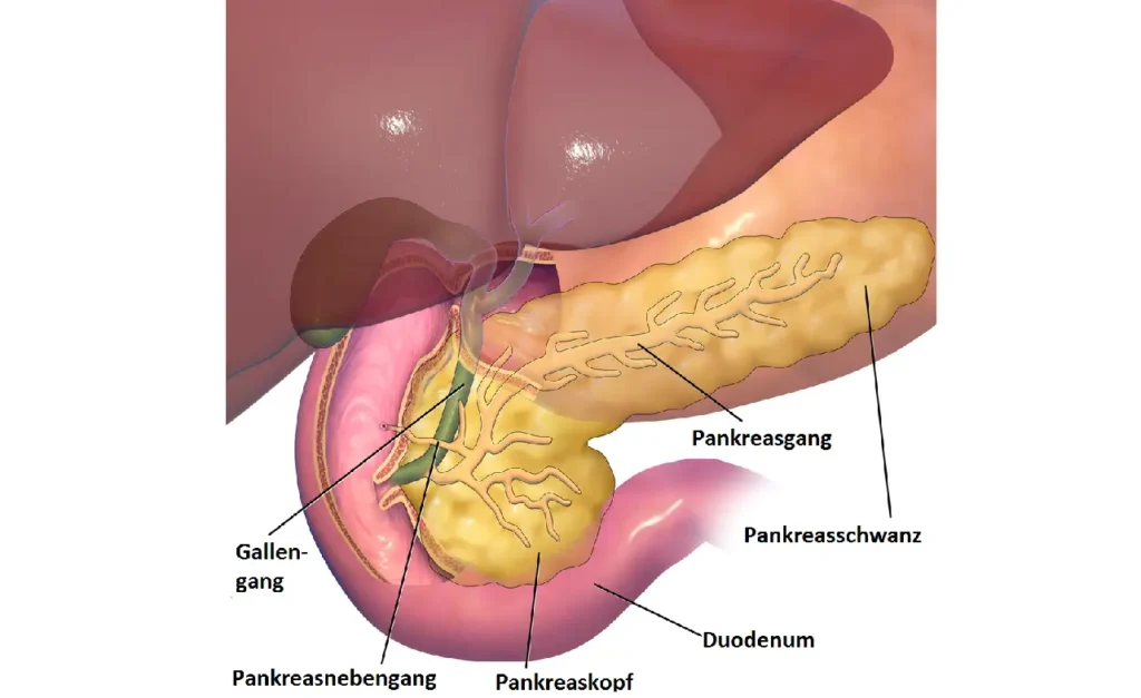 Neuroendokriner Tumor Pankreas Lebenserwartung